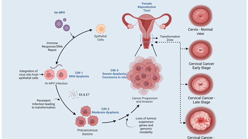 ویروس HPV برای زنان