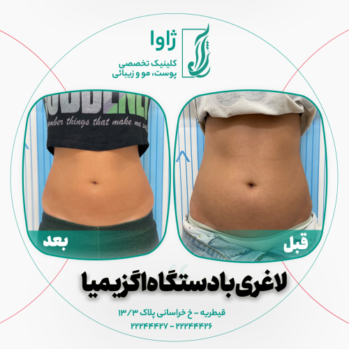 دستگاه لاغری در قیطریه