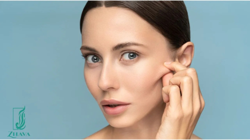 چگونه گونه های خود را میتوانیم لیفت کنیم