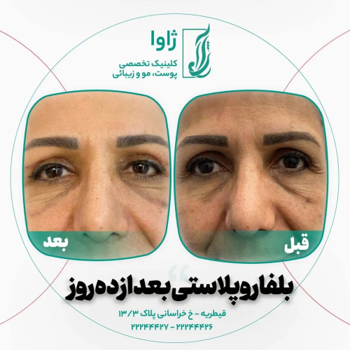 بهترین کلینیک زیبایی قیطریه